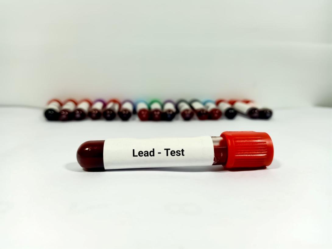 Thousands of children got tested for lead with faulty devices: What parents  should know | The Lund Report