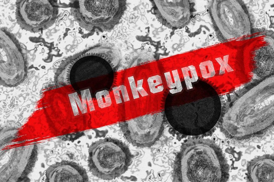 Health authority warns of uptick in cases of mpox, formerly known as  monkeypox – Oregon Capital Chronicle